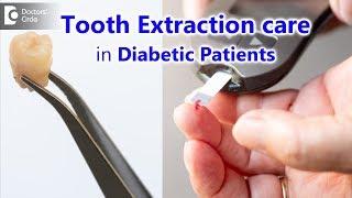 Can diabetic patient get his tooth extracted? | Precautions & Tips- Dr. Syed Yunus | Doctors' Circle