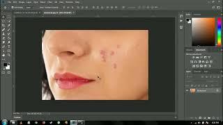 Remove Pimples in Photoshop    SMART GRAPHICS