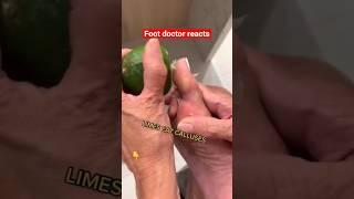 Doctor reacts: foot callus lifehack