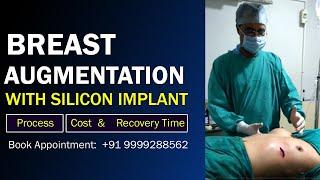 Breast Augmentation with Silicon Implant | Breast Augmentation Delhi, Cost, Process | Dr PK Talwar