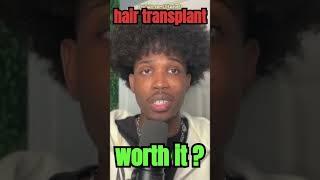 Is Hair Transplant Surgery ‍️ Worth the Cost? 