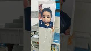 Baby Palate Surgery