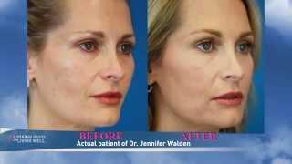 Microneedling with Collagen P.I.N. on KVUE TV