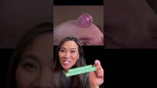 Dr Pimple Popper Explains Forehead Growth!