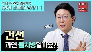 건선? 불치병이라고?ㅣ건선 치료방법 소개