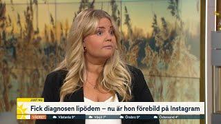 Influencern fick lipödem – okända diagnosen drabbar många | Nyhetsmorgon | TV4 & TV4 Play