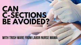 How Can I Avoid a C-Section? | Labor Nurse Mama