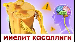 миелит  касаллиги | сабаблари | даволаш усуллари...