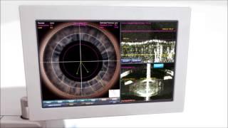 Bladeless Laser Cataract Surgery at The Eye Associates