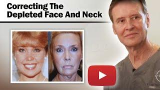 Female Facelift - Correcting The Depleted Face And Neck - Dr. Gerald O'Daniel