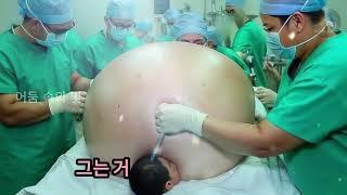 의사가 11세 소녀의 배 속에 무엇인가를 발견했을 때 거의 기절할 뻔했습니다.