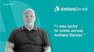 Hollywood Smile Transformation | Antlara Dental Clinic Antalya | Turkey