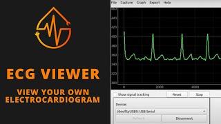 ECG Viewer Install for Windows and MacOS