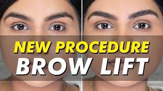 Brow Lift by Nadia Afanaseva | Eye Design New York