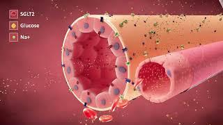 The Cellular Actions of SGLT2i's