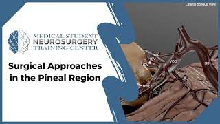 Surgical Approaches in the Pineal Region