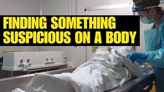 Finding something suspicious on a body