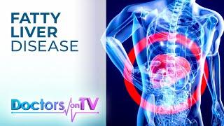 Fatty Liver Disease | Doctors on TV