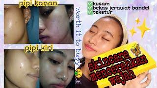 SKINCARE UNTUK MENCERAHKAN & MENGHILANGKAN NODA HITAM BEKAS JERAWAT  ||  #MerryView YUJA NIACIN