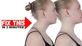 3 MINUTE Neck Hump FIX