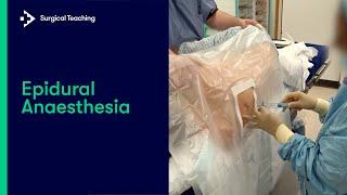 Epidural Anaesthesia: What is it and How Do We Perform it?