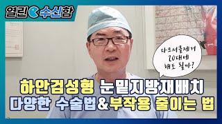 하안검성형, 다양한 수술법과 부작용 [열린 수신함 32편] 레알성형외과 김수신 박사의 성형외과 의사가 본 세상이야기