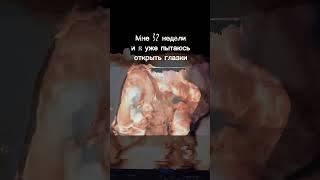 История одного малыша…