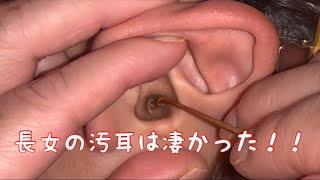 【耳かき】長女の汚耳すごかった【EAR WAX】