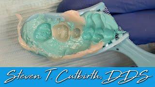Easy Temporary Fabrication - Dental Minute with Steven T. Cutbirth, DDS