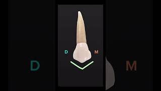 Dental Morphology: the PREMOLAR (vestibular face)