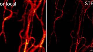 Конфокальные и STED изображения. 1.5 часа съемки (100 кадров) - 1 область