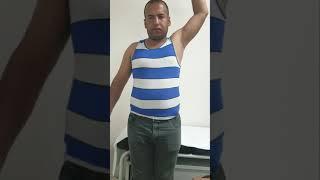 Rt.BRACHIAL PLEXUS REPAIR by Dr.Manish Nanda (M.S,M.Ch).