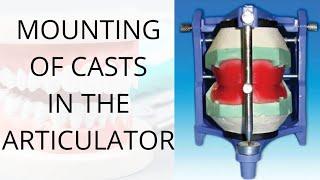 Mounting of casts in the articulator | Preclinical Prosthodontics