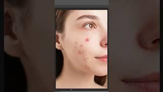 Skin Retouching Trick I Tried SKIN RETOUCHING using Ai Photoshop Best Prompts