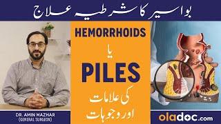 Bawaseer Ka Ilaj Urdu/Hindi- How To Treat Hemorrhoids - Piles Symptoms - Bawasir Asan Qudrati Elaj