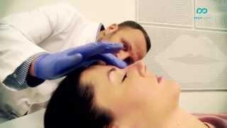 Non surgical nose shaping - Nose Job - Procedure and before and after results