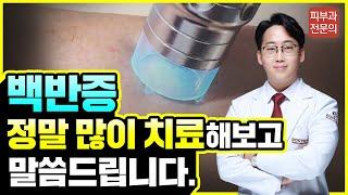 백반증 제대로 치료하는 방법 (피부과전문의, 백반증치료, 백반증레이저)