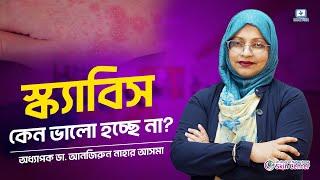 স্ক্যাবিস কেন ভালো হচ্ছে না #খুজলি #scabies