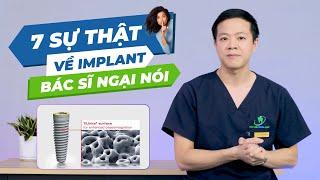 7 Điều Bạn Nên Biết Trước Khi Trồng Chân Răng Nhân Tạo Implant