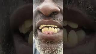 Bade back running around Nannyville track this morning June 17. 202(5 Nannyville Kingston Jamaica