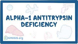 Alpha-1 Antitrypsin Deficiency - causes, symptoms, diagnosis, treatment, pathology