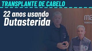 Dutasterida e transplante capilar (Depoimento de paciente que usa há 22 anos)