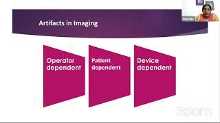 AIOS ARC PG BRAINSTORMER SESSION CLINICAL IMAGING IN GLAUCOMA AND CATARACT - Dr.Sharmila R