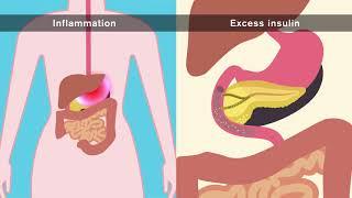 How does obesity cause cancer?