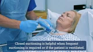 Suctioning (National Tracheostomy Safety Project)