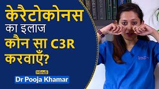 Keratoconus and C3R Corneal Cross Linking Treatment | करैटोकोनस का आधुनिक इलाज | Narayana Nethralaya