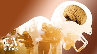 How CTE changes everything about football