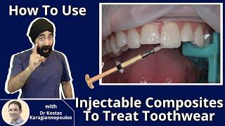 How to Use Injectable Composites To Treat Toothwear MASTERCLASS - PDP081 (Injection Moulding)