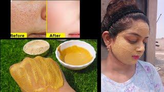 Face Pack For Glowing Skin Homemade | Multani Mitti Face Pack Skin Glowing For All Skin Types