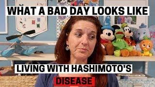 HASHIMOTO'S THYROIDITIS Living with Autoimmune Disease